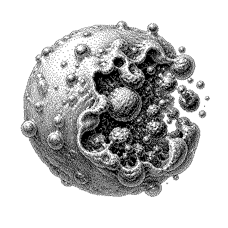 Schema des Zellabbaus: links eine gesunde Zelle, daneben die Apoptose in vier Schritten (Schrumpfen, Zerlegen des Erbguts, Zerfall in kleine Päckchen, Aufnahme durch eine Fresszelle), rechts zum Vergleich die Nekrose, bei der die Zelle anschwillt, platzt und eine Entzündung auslöst.
